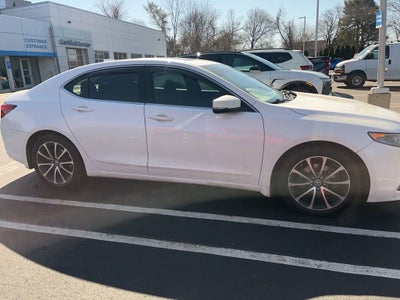2015 Acura TLX V6 Tech